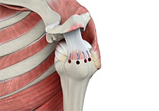 Arthroscopic Rotator Cuff Repair